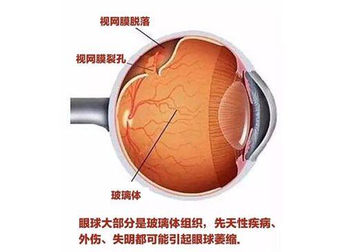 兰州爱尔眼科医院整形科是正规医院吗？