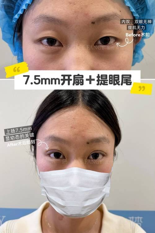 福州珞伊整形医院是正规医院吗?