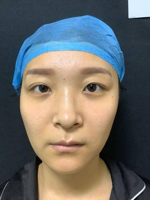 韩国世珍Sejin整形外科特色项目及技术优势