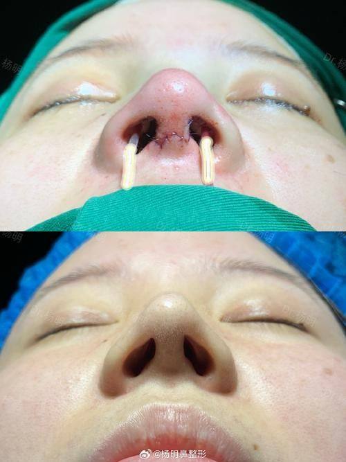 韩国世珍Sejin整形外科详细的预约挂号方式及流程