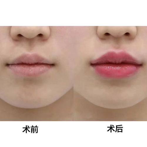 昆明维多利亚医疗美容医院收费价格表/收费标准