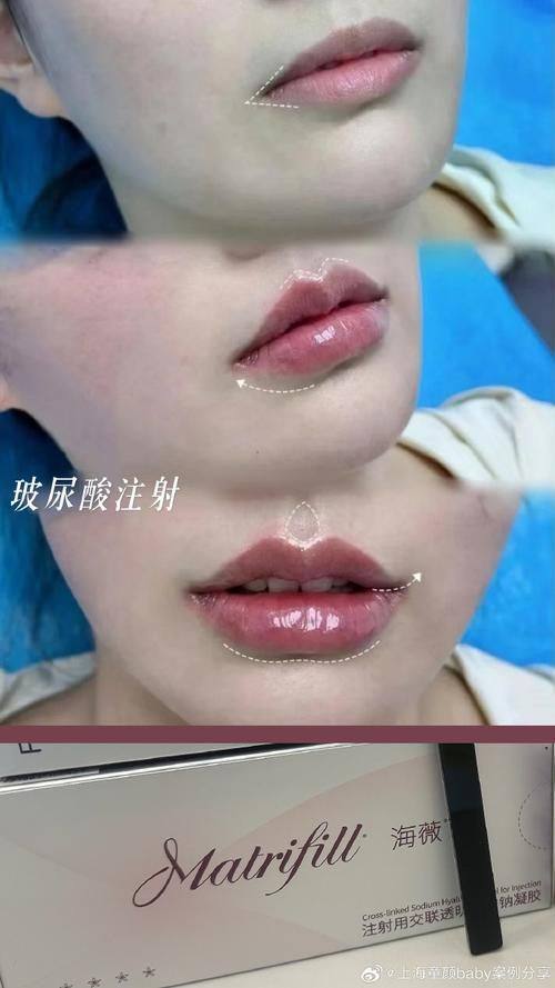 昆明维多利亚医疗美容医院详细的预约挂号方式及流程