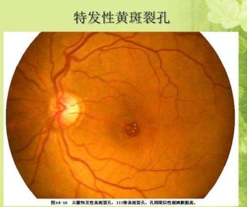 滨州市中 心医院眼科详细的预约挂号方式及流程