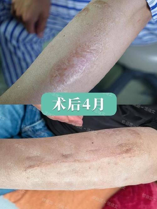 拉萨新丽澳医疗美容诊所真人口碑评价怎么样？