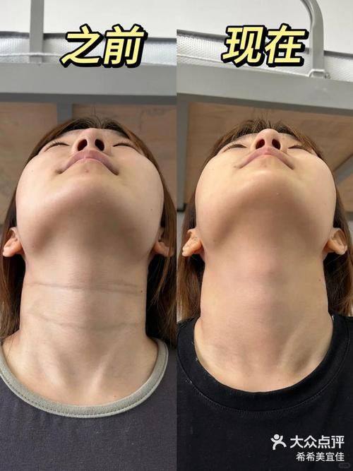 北京美易美时代医美诊所特色项目及技术优势