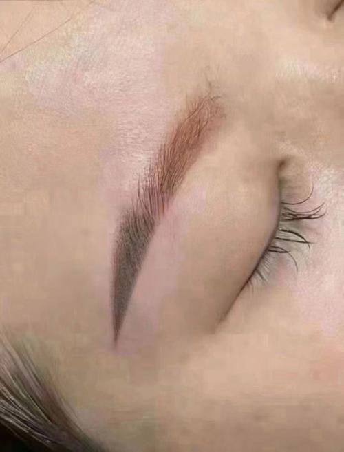 福州珞伊整形医院特色项目及技术优势