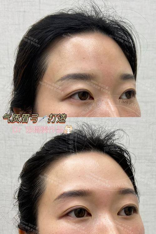 昆明维多利亚医疗美容医院是正规医院吗？