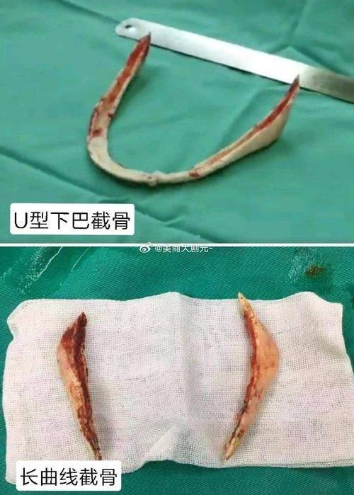 韩国世珍Sejin整形外科收费价格表/收费标准