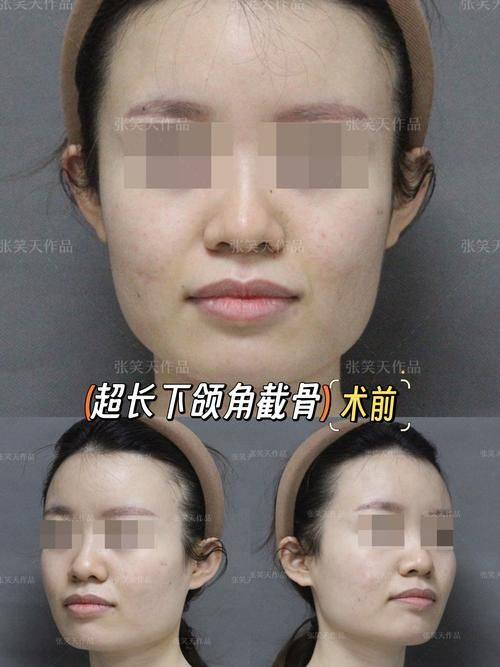 韩国theall medical hub整形外科收费价格表/收费标准