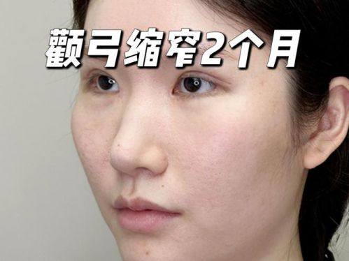 韩国theall medical hub整形外科特色项目及技术优势