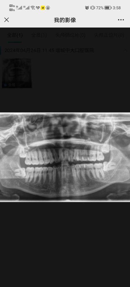 内蒙古呼伦贝尔牙克石乐齿口腔门诊部特色项目及技术优势