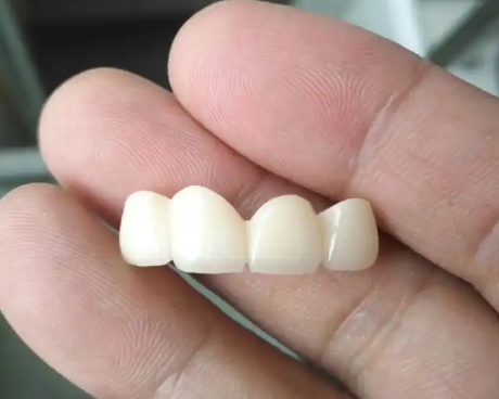 内蒙古呼伦贝尔牙克石乐齿口腔门诊部收费价格表/收费标准