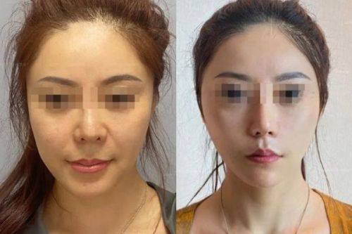 连云港市俏脸整形特色项目及技术优势