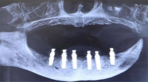 山东泰安崇锦口腔详细的预约挂号方式及流程