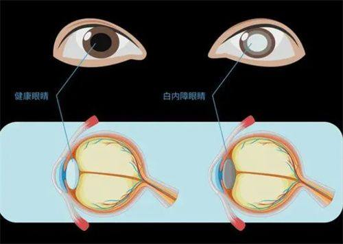 哈尔滨市第一医院眼科详细的预约挂号方式及流程
