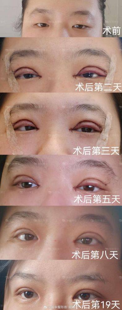 深圳金丽医疗美容医院收费价格表/收费标准