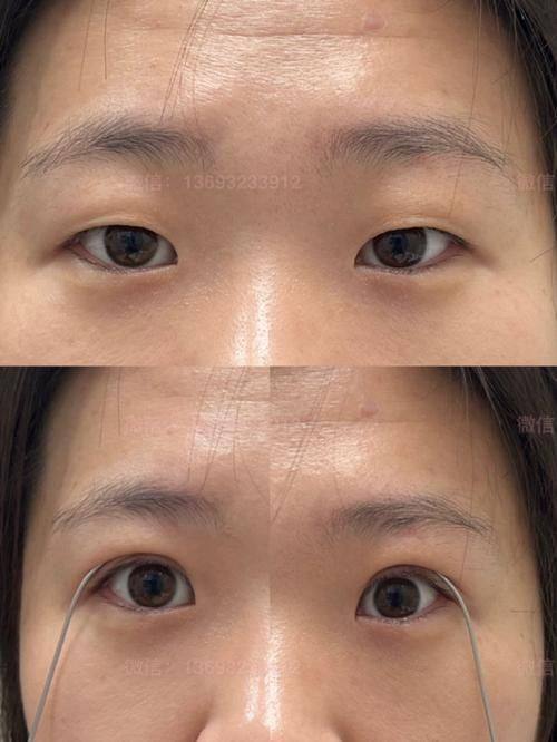 成都莱尹医疗美容整形医院真人口碑评价怎么样？