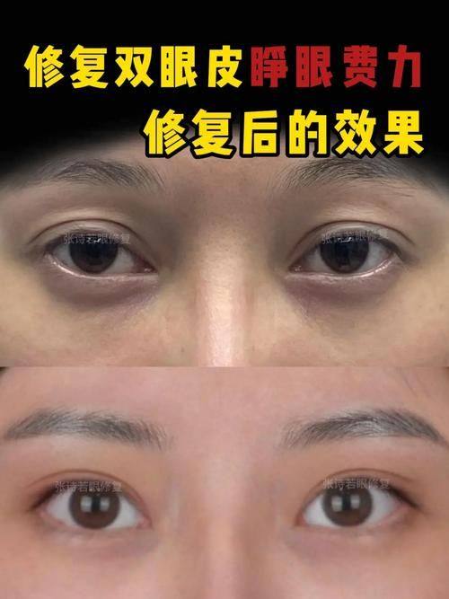 成都美辰星耀医疗美容整形门诊部详细的预约挂号方式及流程