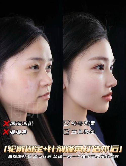 成都美辰星耀医疗美容整形门诊部是正规医院吗？