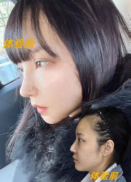 深圳金丽医疗美容医院真人口碑评价怎么样？