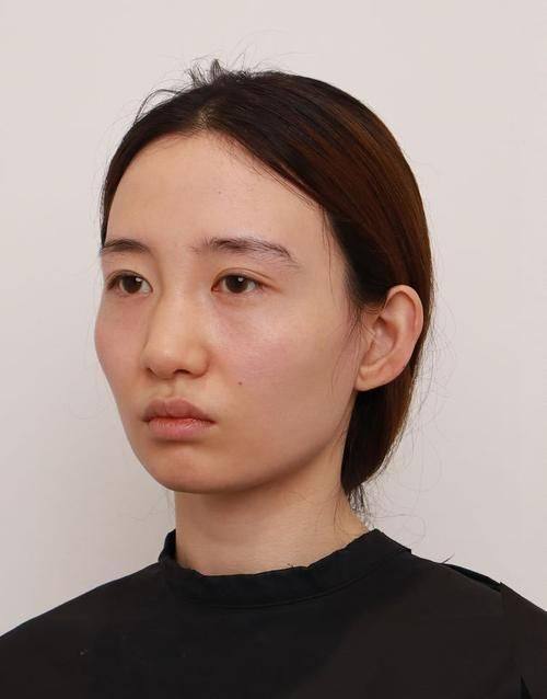 成都莱尹医疗美容整形医院详细的预约挂号方式及流程