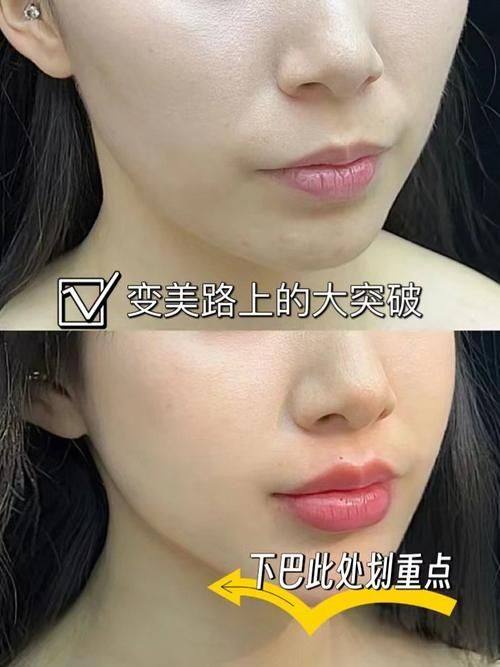 成都莱尹医疗美容整形医院收费价格表/收费标准