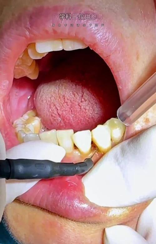 江苏淮安市明洁口腔真人口碑评价怎么样？