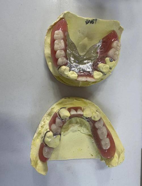 湖北省中医院口腔科收费价格表/收费标准