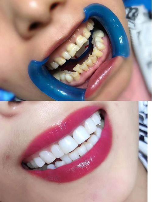 山东泰安崇锦口腔真人口碑评价怎么样？