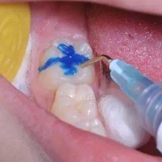 湖北省中医院口腔科真人口碑评价怎么样？