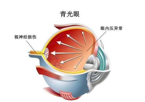 萍矿总医院眼科特色项目及技术优势