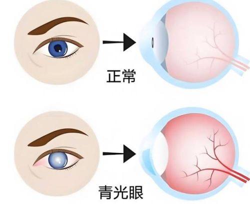 萍矿总医院眼科医生团队实力强大及骨干医生简介