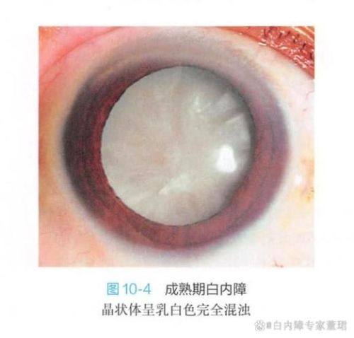 萍矿总医院眼科收费价格表/收费标准
