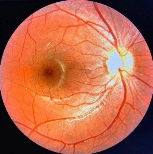 萍矿总医院眼科详细的预约挂号方式及流程