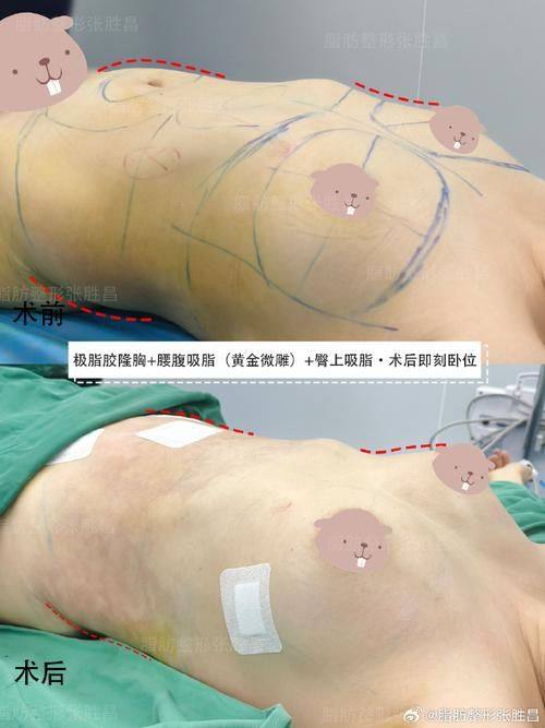 深圳金丽医疗美容医院是正规医院吗？