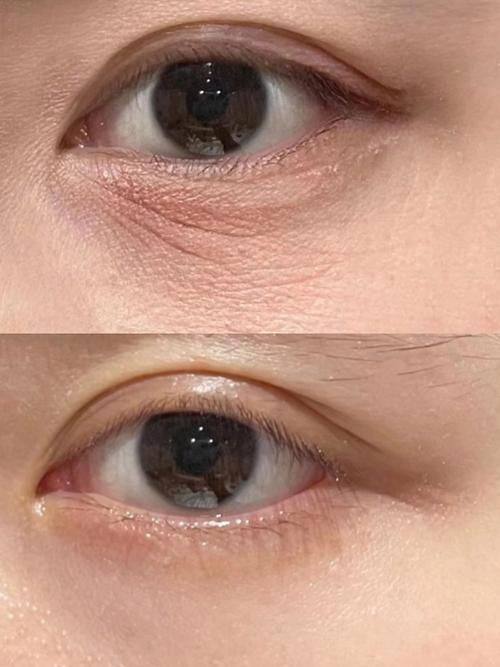 杭州俐德嘉医疗美容诊所真人口碑评价怎么样？