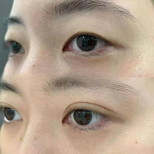 北京华真堂医疗美容真人口碑评价怎么样？