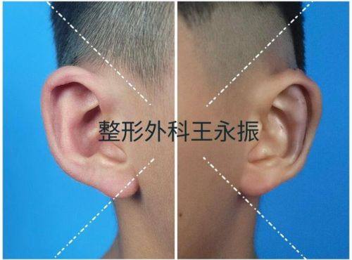 杭州俐德嘉医疗美容诊所是正规医院吗？