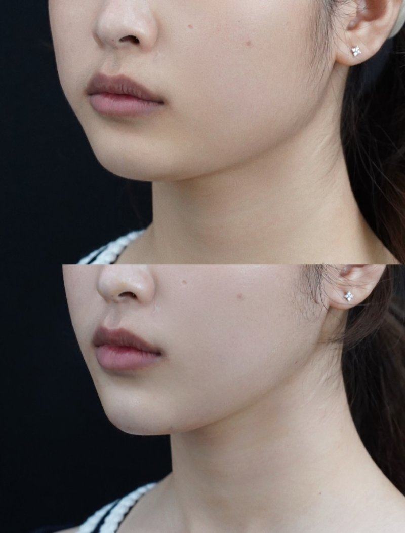 连云港市俏脸整形收费价格表/收费标准