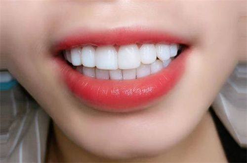 云南昆明寻甸博美口腔收费价格表/收费标准