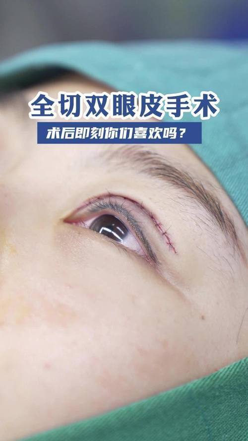 昆明华连众美整形医疗美容门诊部地址电话营业时间