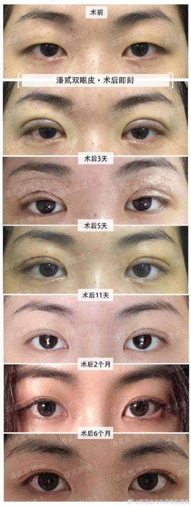 芜湖美人鱼医疗美容诊所收费价格表/收费标准