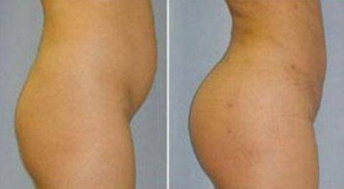 韩国美人整形外科医院真人口碑评价怎么样？