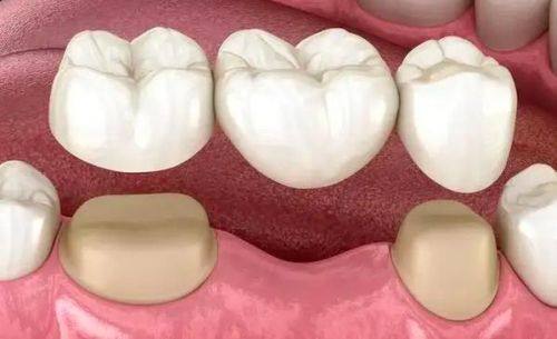 洛阳拜博口腔（景华路拜尔口腔门诊部）收费价格表/收费标准