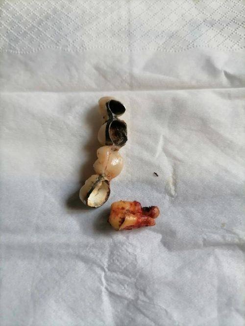 深圳欧卡多口腔门诊部真人口碑评价怎么样？