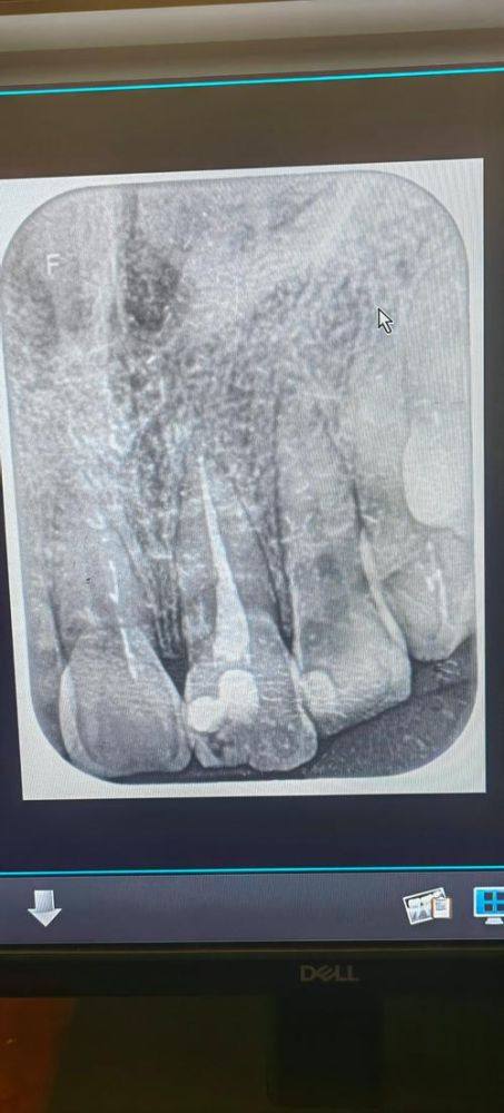 云南昆明寻甸博美口腔特色项目及技术优势