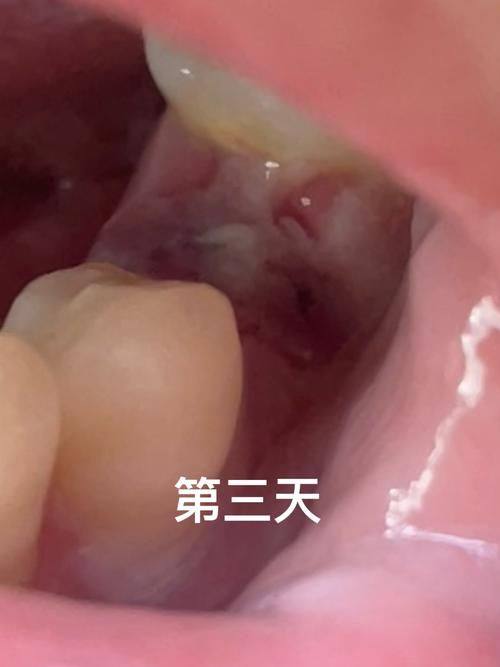 云南昆明寻甸博美口腔详细的预约挂号方式及流程