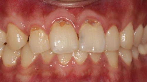 云南昆明寻甸博美口腔地址电话营业时间