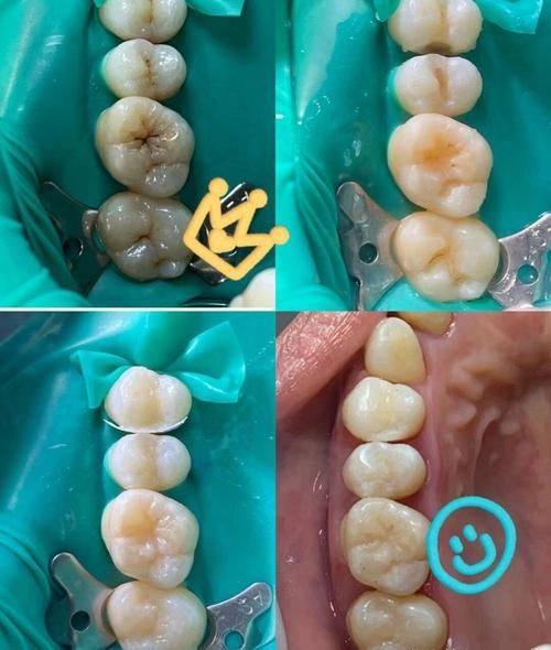 洛阳拜博口腔（景华路拜尔口腔门诊部）是正规医院吗？