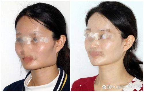 上海同济大学附属天佑医院皮肤美容中 心是正规医院吗?